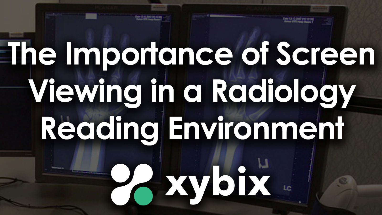 The Importance of Screen Viewing in a Radiology Reading Environment